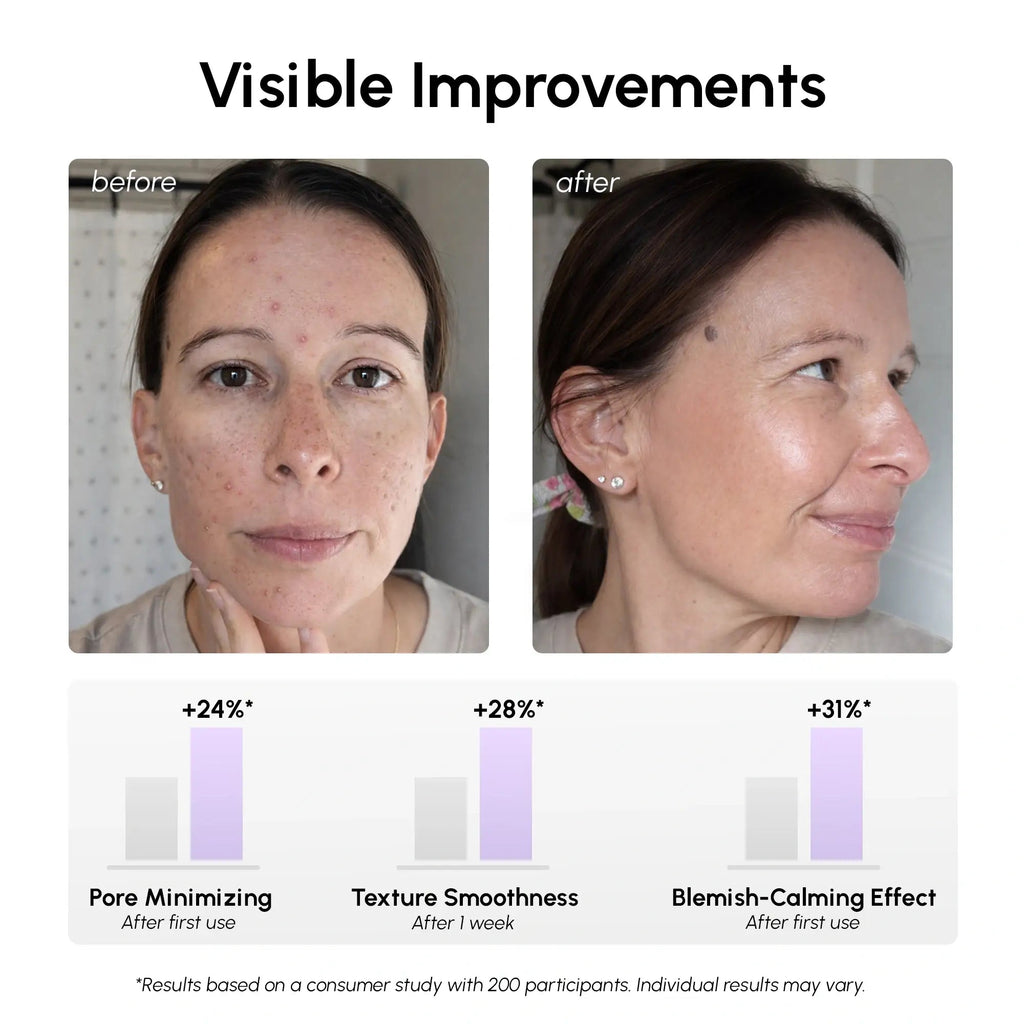 12% Niacinamide Smooth & Glow Pads - SNMShop