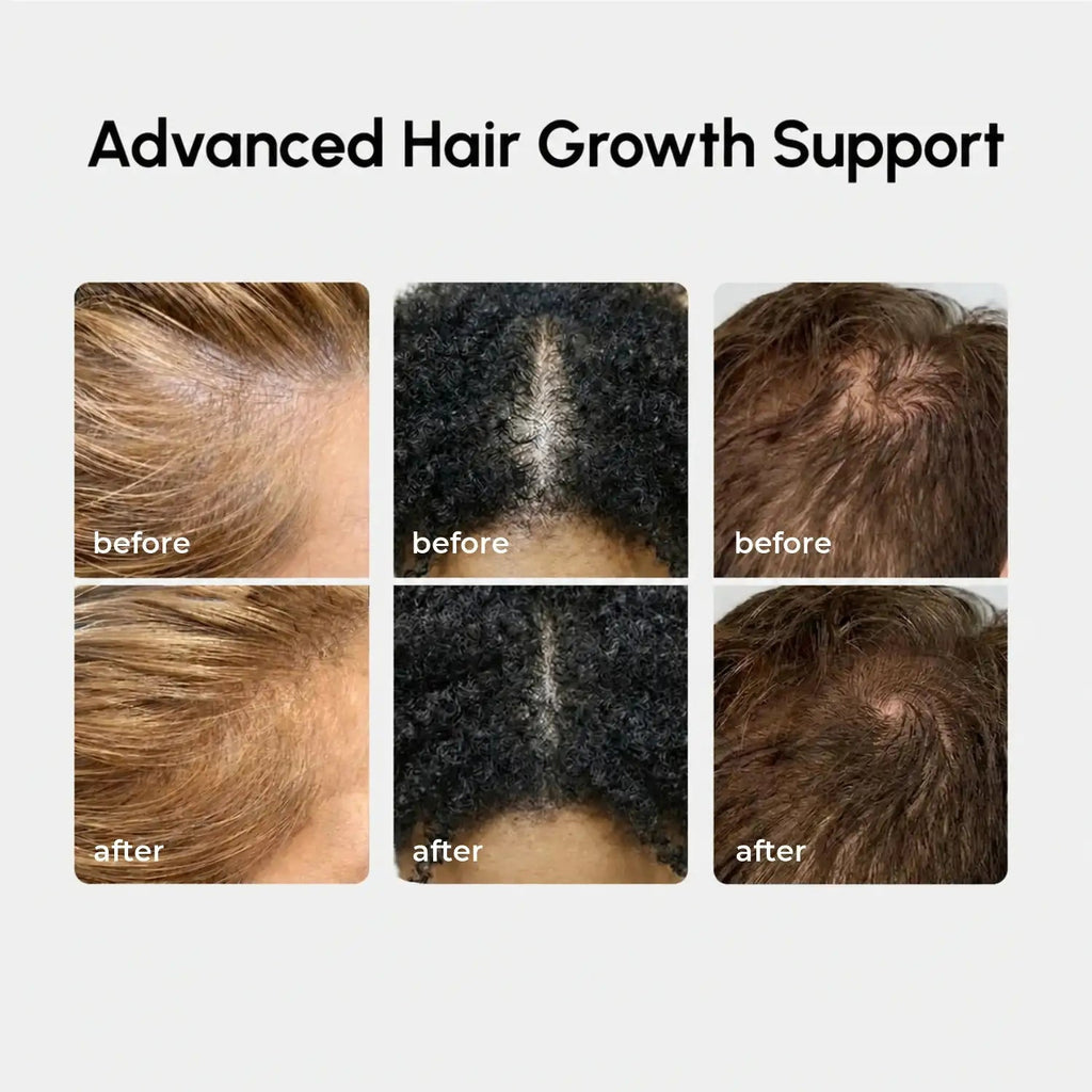 4-in-1 Hair Growth Spray - SNMShop