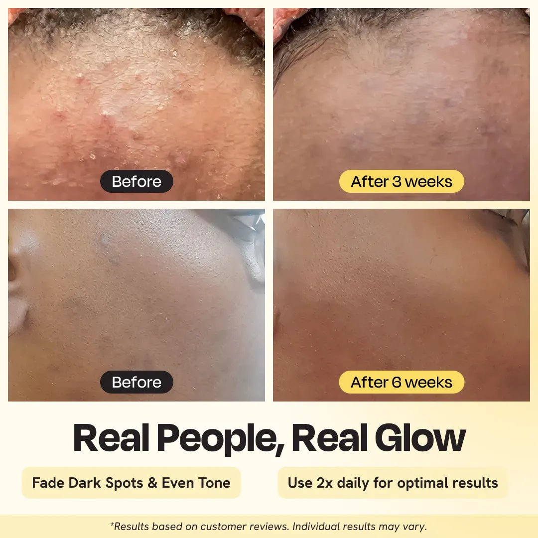 Advanced Brightening Moisturizer - SNMShop