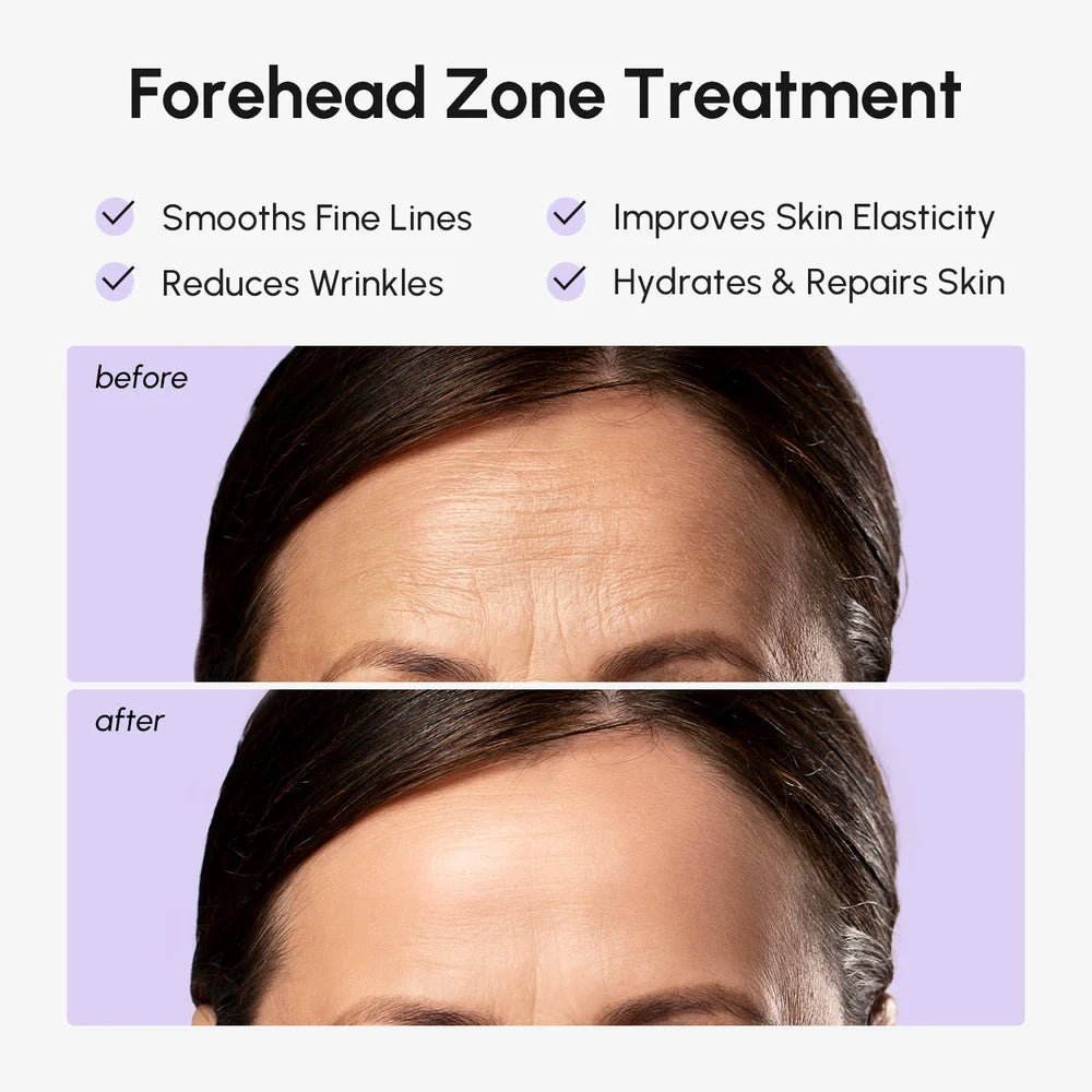 Anti-Wrinkle Forehead Patches - SNMShop