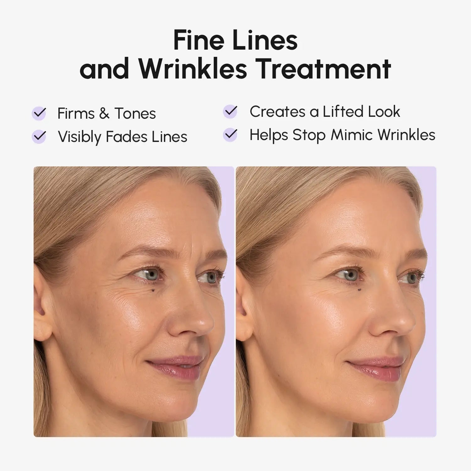 Anti-wrinkle Tape Patches - SNMShop