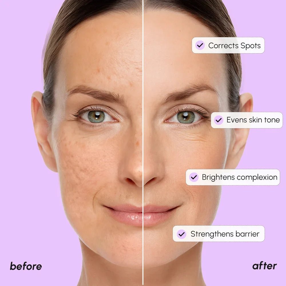 Dark Spot Corrector - SNMShop