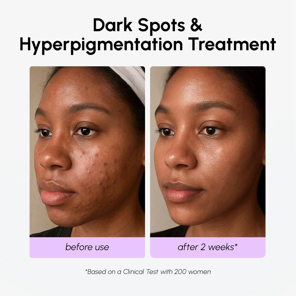 Dark Spot Corrector - SNMShop