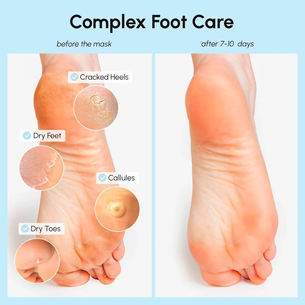 Exfoliating & Hydrating Foot Mask - SNMShop