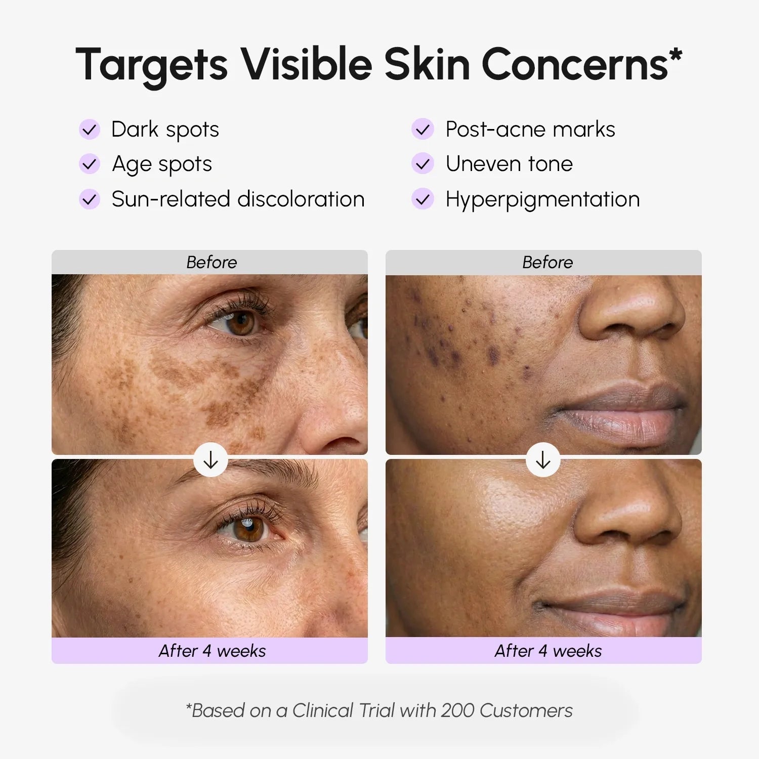 Face & Body Serum for Dark Spots - SNMShop