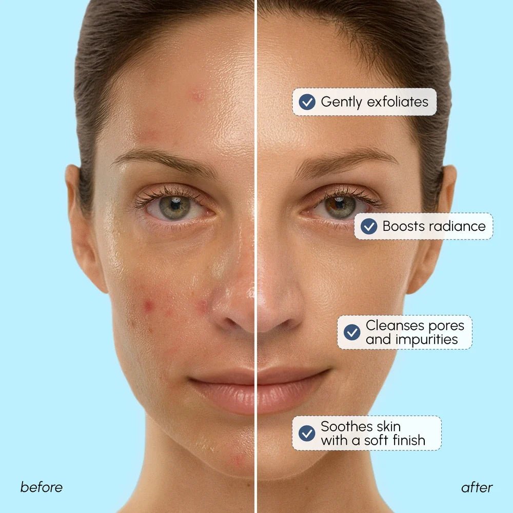 Face Polishing Scrub & Exfoliator - SNMShop