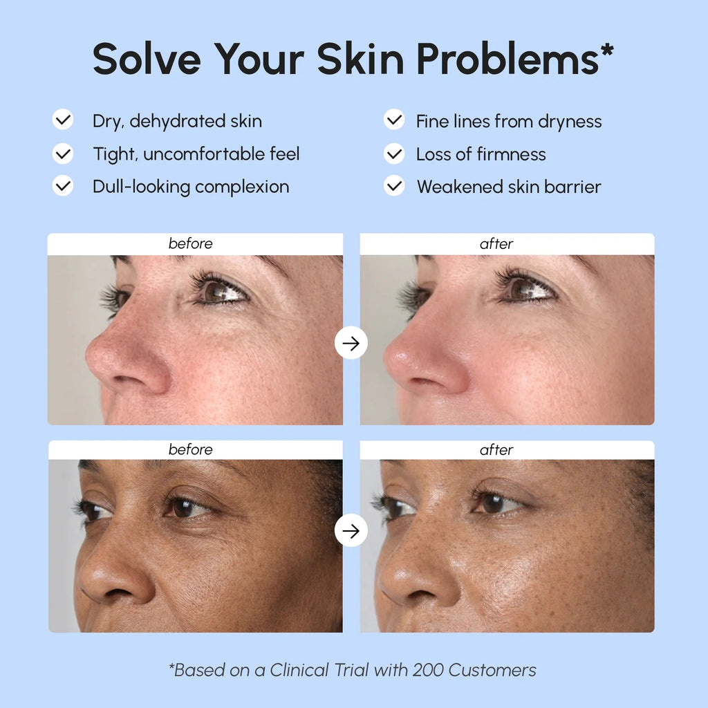 Firming & Lifting Collagen Moisturizer - SNMShop