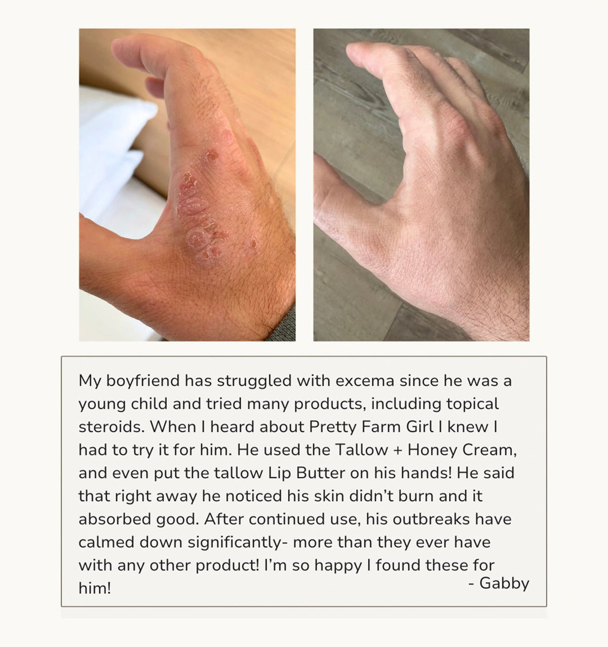 Fragrance Free Tallow + Honey Cream for Sensitive Skin - SNMShop