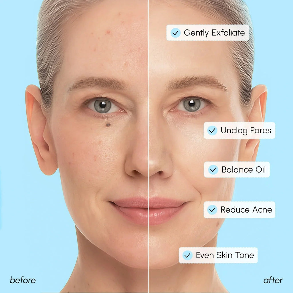 Glycolic & Salicylic Acid Peel Pads - SNMShop