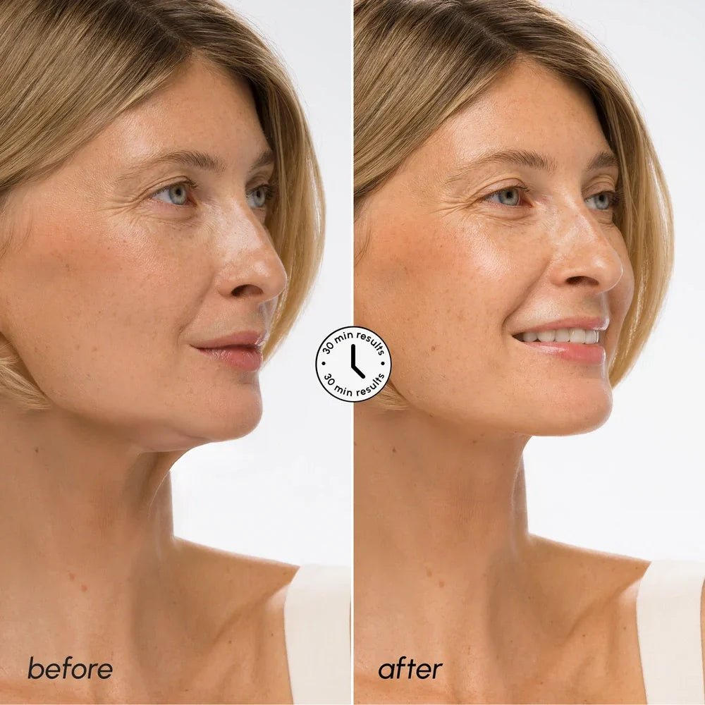 Hyaluronic Acid V-line Lifting Mask - SNMShop