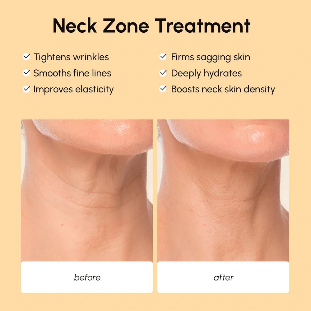 Lifting Neck Wrinkle Patches - SNMShop