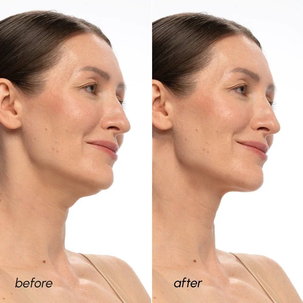 PDRN V-line Lifting Mask - SNMShop