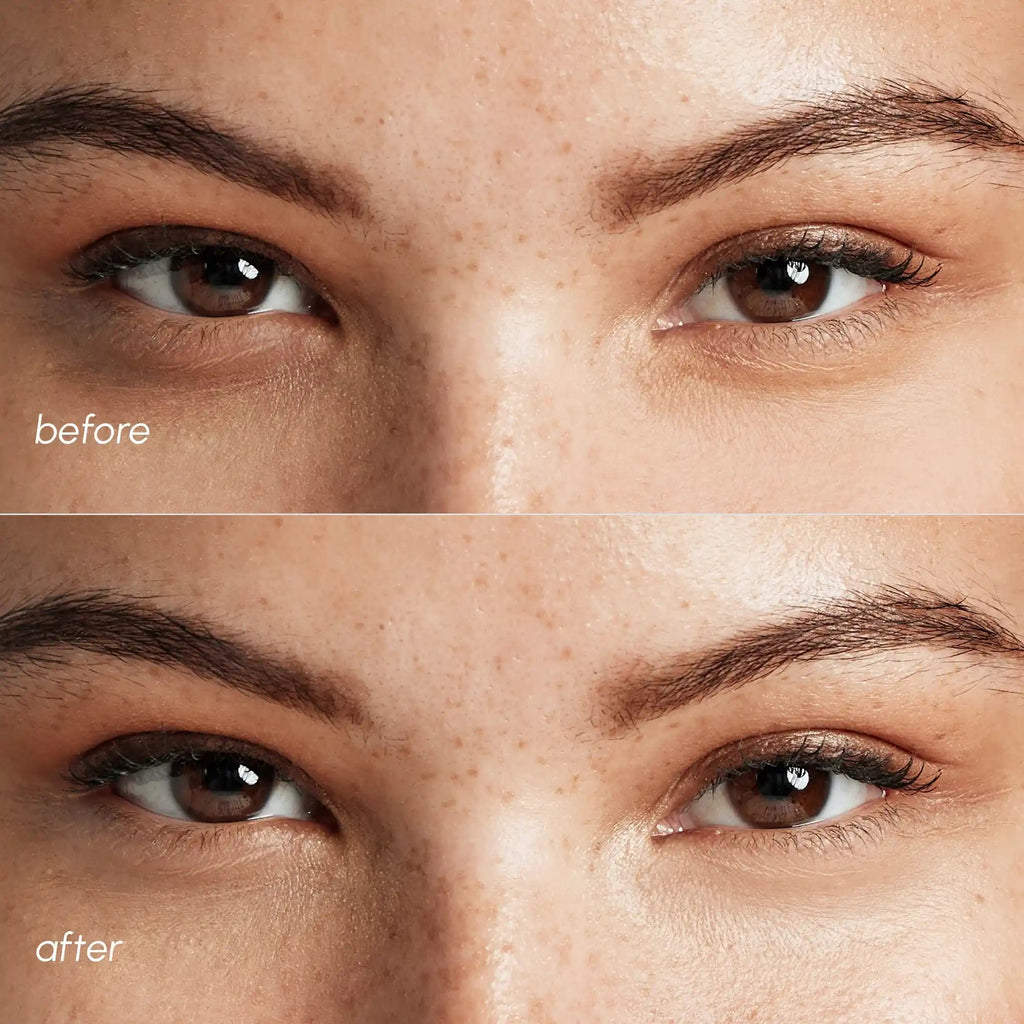 Pink Eye Patches for Puffy Eyes - SNMShop