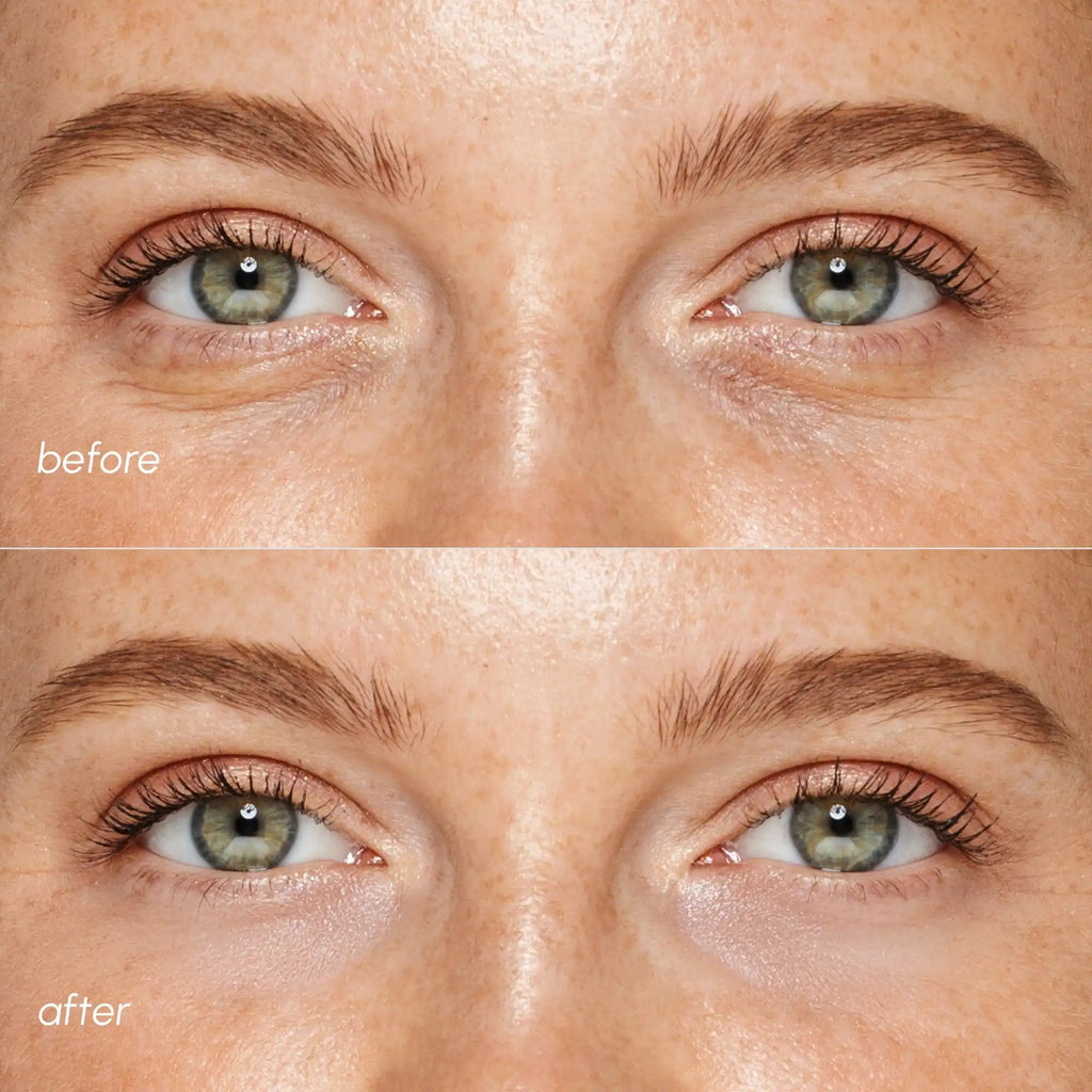Pink Eye Patches for Puffy Eyes - SNMShop