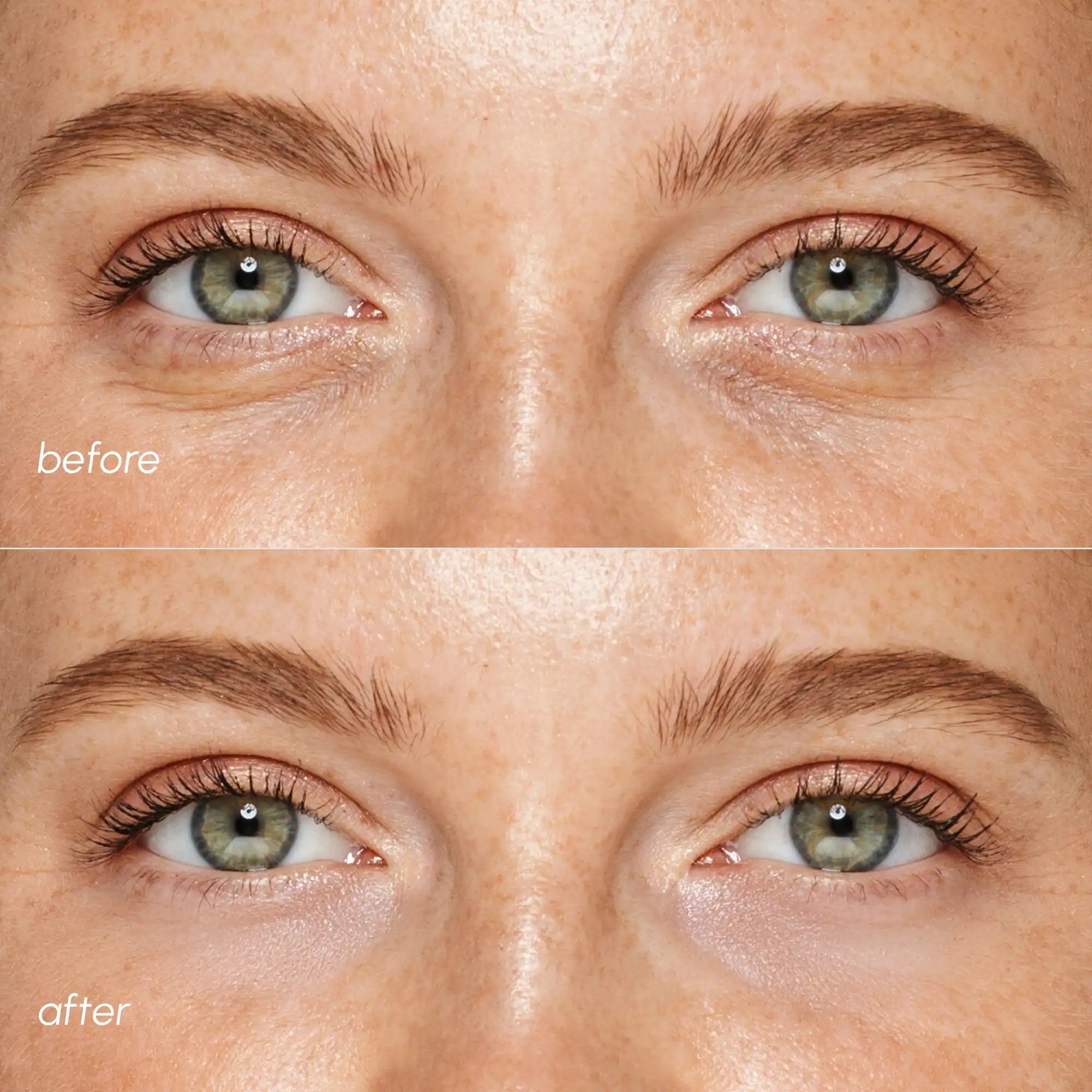 Pink Eye Patches for Puffy Eyes - SNMShop