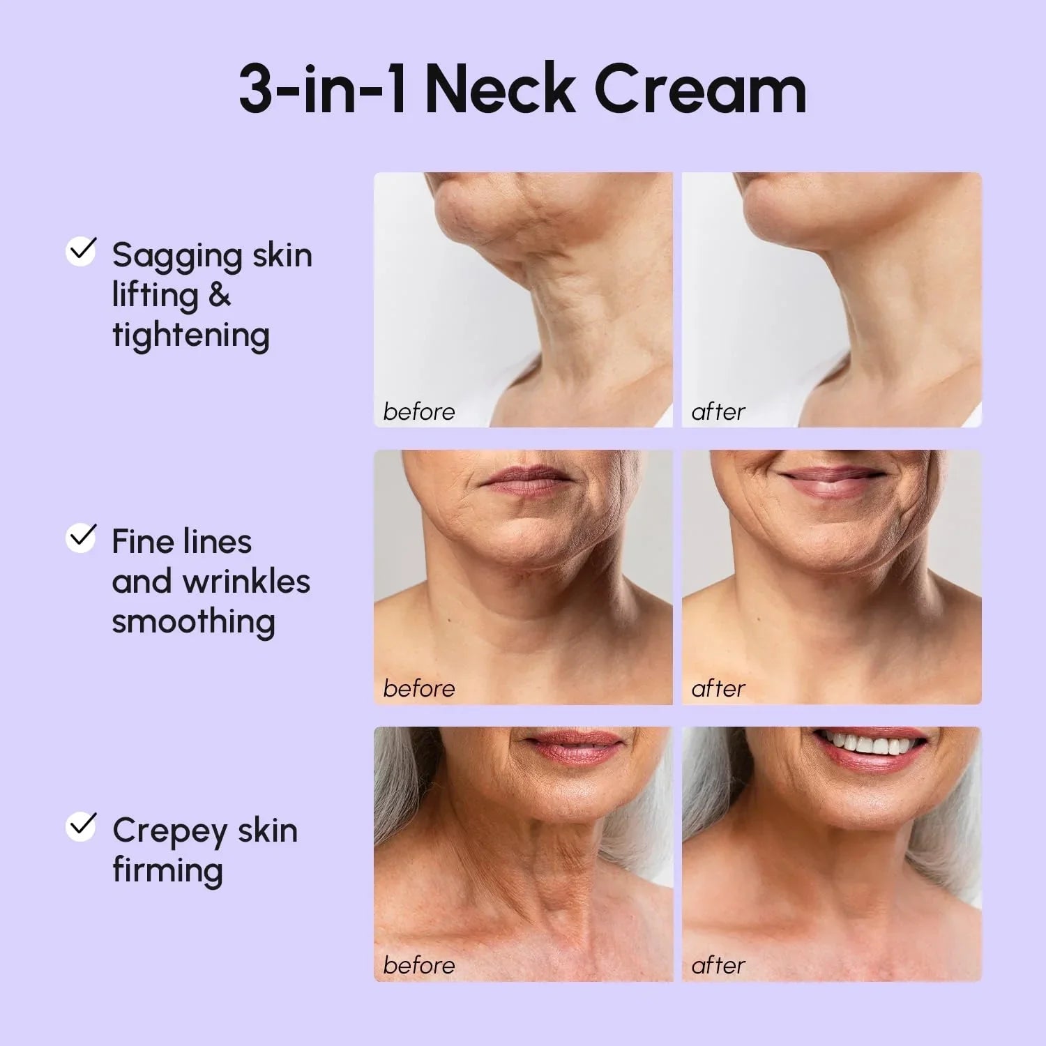 Pro-Retinol Neck Lifting Cream Massager - SNMShop