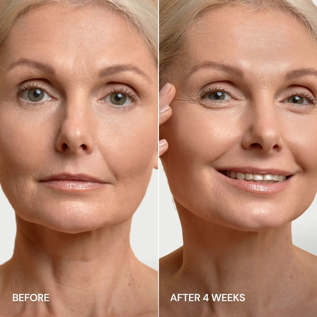Pro-Retinol Neck Lifting Cream Massager - SNMShop