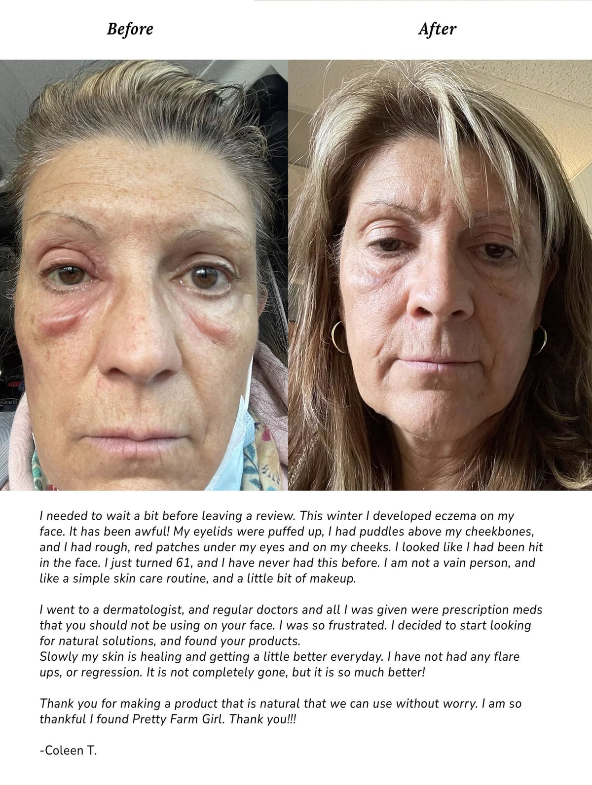 Pure + Simple Skin Kit for Sensitive Skin - SNMShop