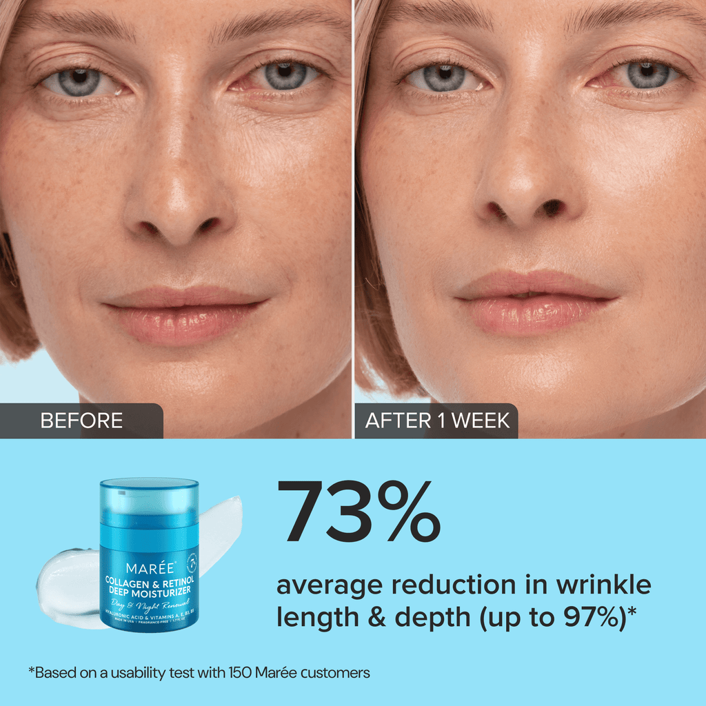 Retinol & Collagen Anti-Age Cream - SNMShop