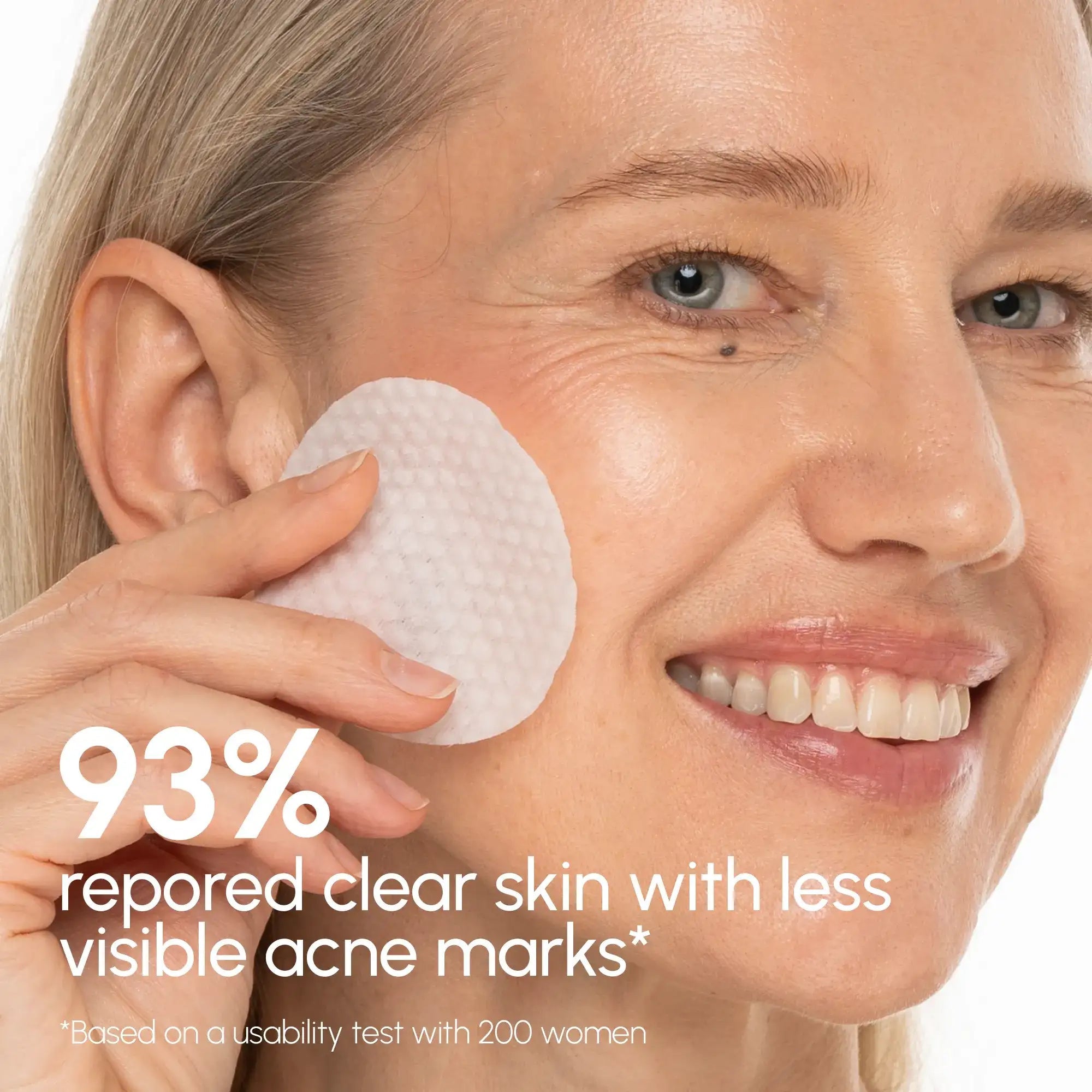 Witch Hazel Clearing Pads - SNMShop