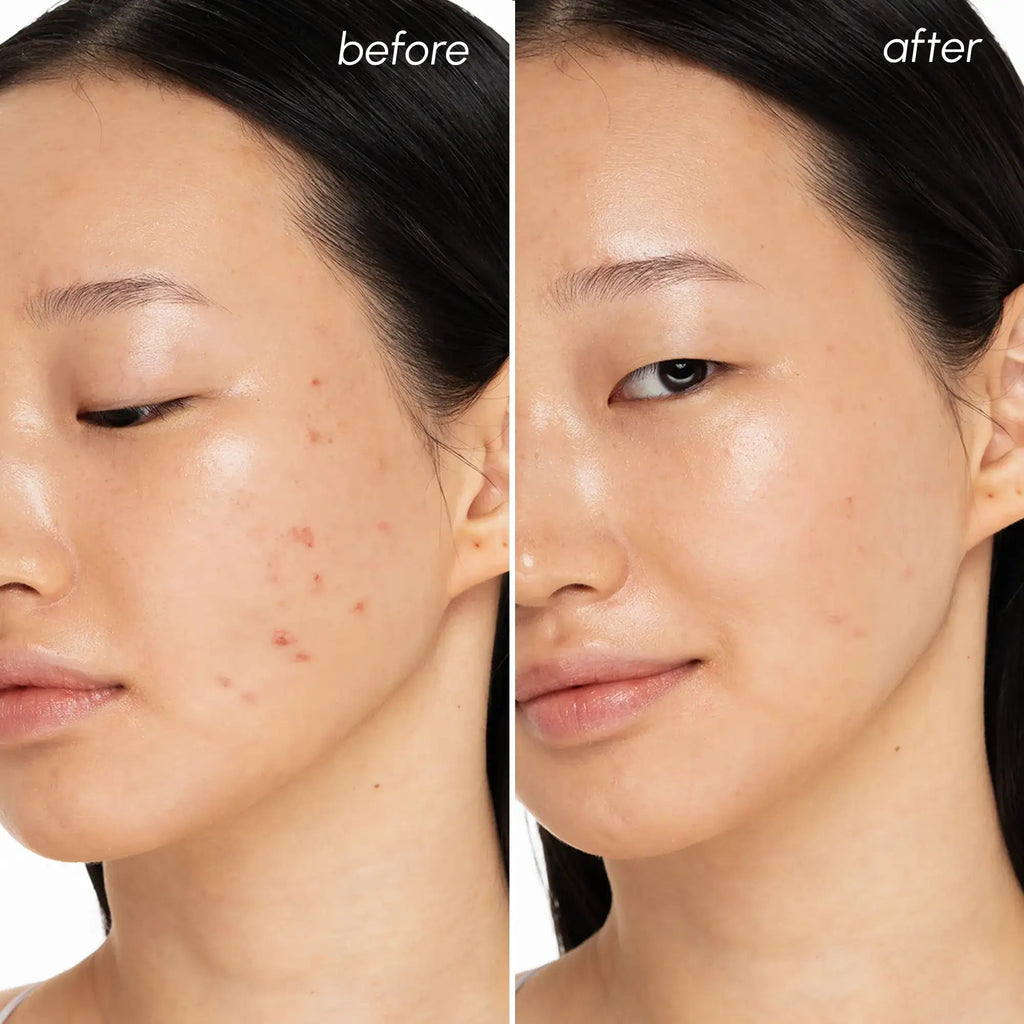 Witch Hazel Clearing Pads - SNMShop